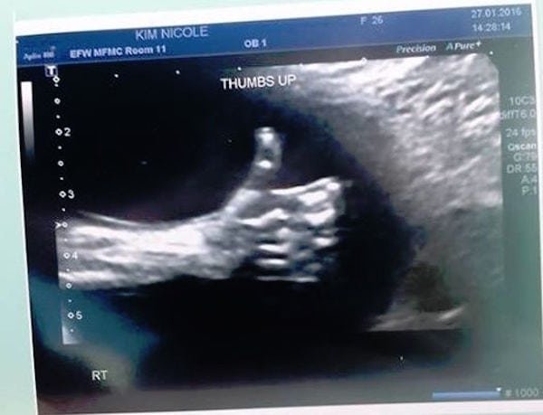 Un feto da un inesperado mensaje a sus padres desde una ecografía