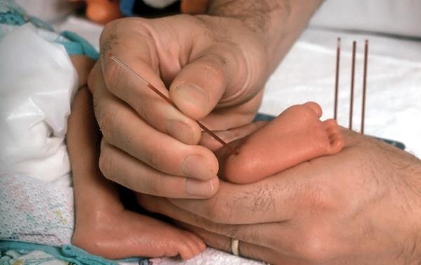 Estudios para la detección de enfermedades del recién nacido