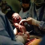 ¿Temerle a la cesárea? La experiencia de Jimena