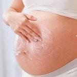 Tratamiento y prevención de estrías durante el embarazo
