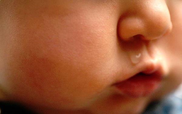 Limpieza de la nariz del bebé con aspirador nasal