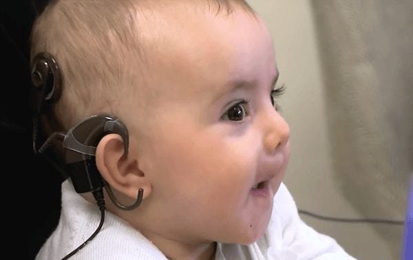 Una bebé sorda escucha por primera vez a su mamá a los 8 meses