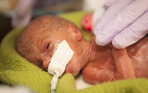 Emotivo timelapse de la lucha de un bebé prematuro