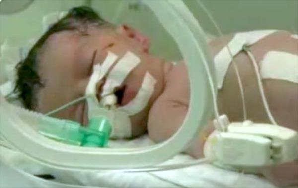 La bebé que nació de una madre muerta en Gaza