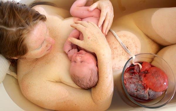 Parto o nacimiento Lotus: Cuando se deja la placenta y el cordón adherido al bebé