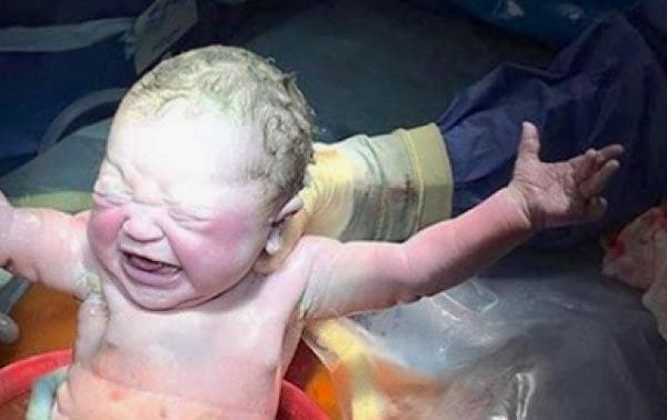 La increíble imagen de una cesárea que se hace viral y asombra en Internet