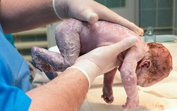 Los expertos recomiendan retrasar el primer baño del recién nacido