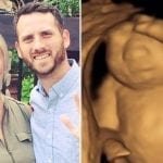 Su bebé nacerá sin cerebro y sigue con el embarazo para donar sus órganos
