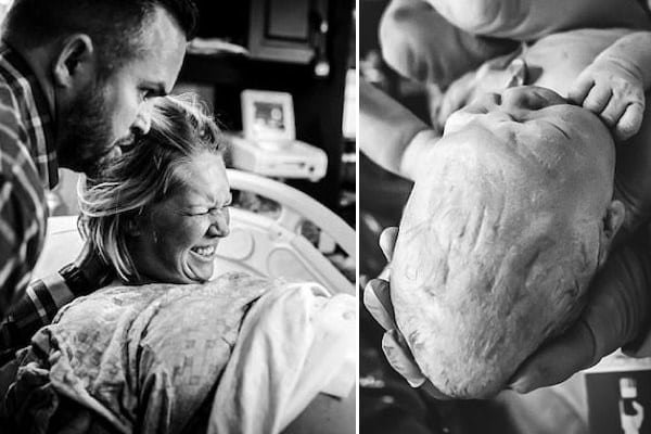 Impresionantes imágenes muestran cómo se amolda la cabeza del bebé en el canal de parto