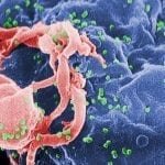 Desarrollan un anticuerpo que ataca el 99% del virus del VIH