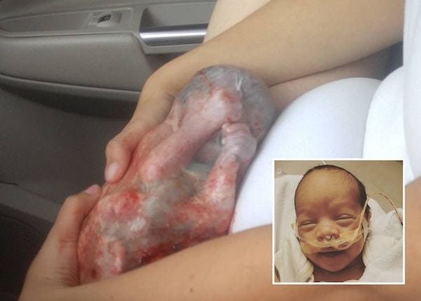 Una mujer da a luz en el auto a su bebé con su saco amniótico intacto