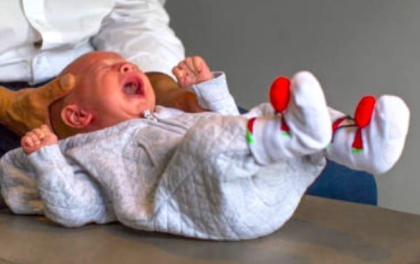 Disquecia del lactante: cuando el bebé puja fuerte como para hacer caca y no está estreñido