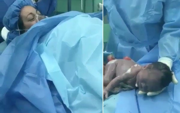 El increíble video de un bebé que sale “gateando” de la panza en la cesárea de su mamá