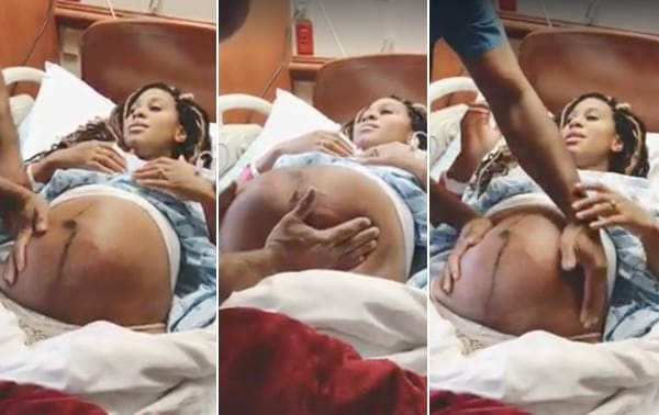 Una pareja comparte el video de un procedimiento doloroso para dar vuelta al bebé antes del parto