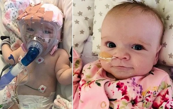 Bebita de 6 meses superó un operación de corazón y ahora lucha contra el coronavirus